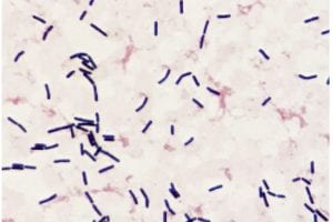 gram-positive-rods