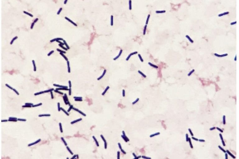 Gram positive Bacteria found in Indoor Environments