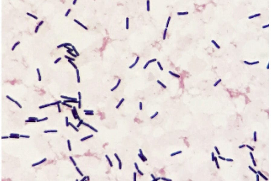 Gram positive Bacteria found in Indoor Environments