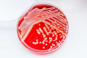 staphylococcus species