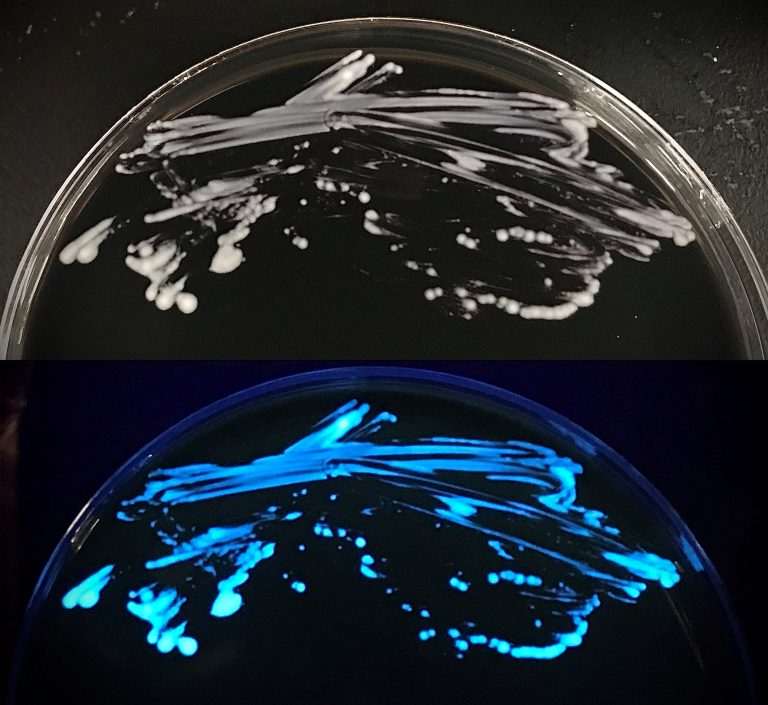Testing for Legionella, the bacterial cause of Legionnaires’ Disease